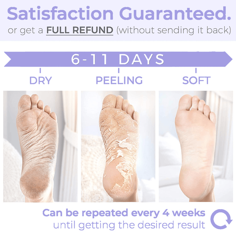 Bliss™ Foot Peel Masks | Exfoliating Callus Remover for Baby Soft Feet | 2 pairs (4 masks)