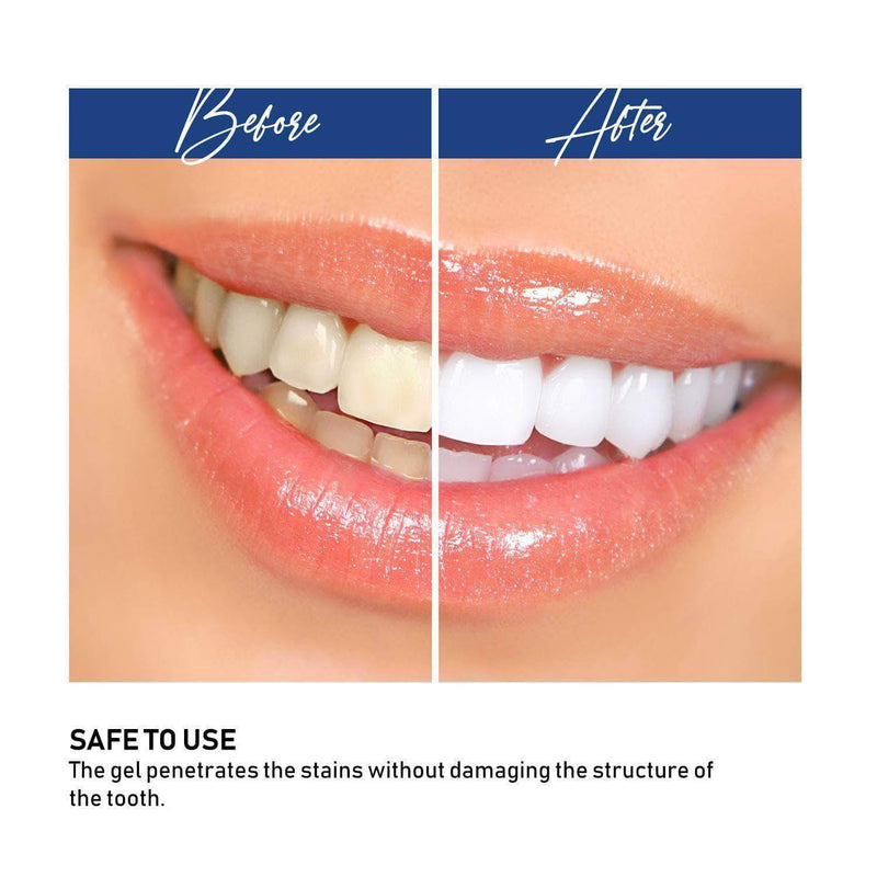 Bright Smile White Light Tooth Whitening Teeth with  Whitening Gel - Ooala