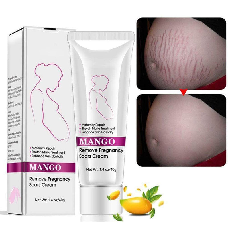 Evetis Mango Stretch Mark Remover | Scar Removal & Anti Aging Cream
