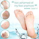 Fashly 1-Pair Exfoliating Foot Peel Mask | Natural Exfoliator for Dry Dead Skin and Callus