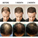 Exfoliz Fast and Powerful Hair Growth Essence for Men & Women - Ooala