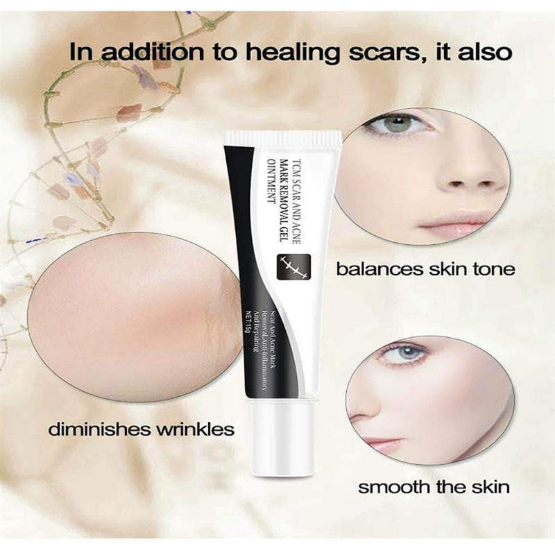 MedPotion Scar Treatment Cream - Acne Spots Treatment, Stretchmark Relief, Burns and Cuts Repair