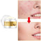 Skinrific Snail Essence Face Cream, Moisturizing, Acne Scar Removal, Repair Damaged Skin - Ooala